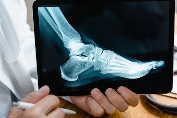 Trouver un orthopédiste à paris : dr rouxel, votre solution santé